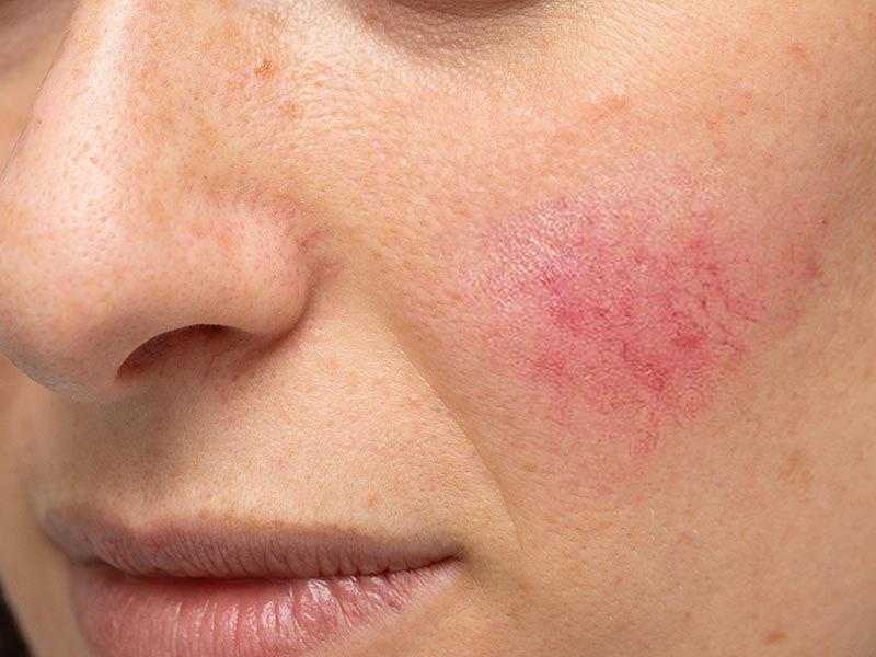 Roseacea-Large-4.jpg