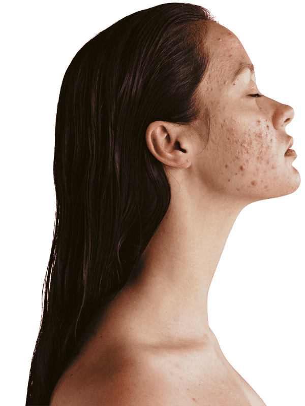 Private Dermatologists Liverpool