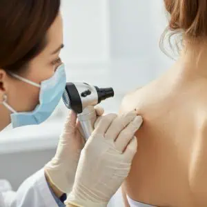 checking moles uk