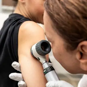 private mole check