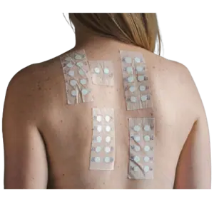 SKIN ALLERGY PATCH TEST